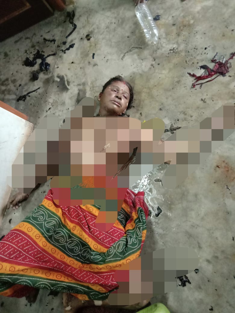 RAIPUR BREAKING : पति-पत्नी में हुआ विवाद, पत्नी ने मिट्टीतेल डालकर की आत्महत्या की कोशिश, हालत गंभीर 