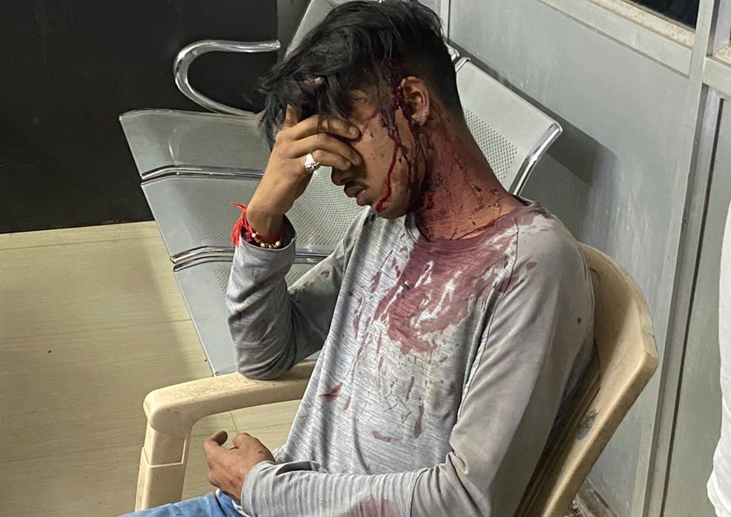 राजधानी में सरेराह लूट, चाकू की नोक पर वारदात, मारपीट के बाद एक युवक की हालत गंभीर