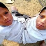 'दो जिस्म एक जान', मशहूर जुड़वा भाई शिवराम और शिवनाथ की, संदिग्ध मौत से हड़कंप
