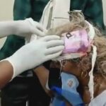  OMG : कंडोम का पैकेट लगाकर कर दी महिला के सिर पर चोट की मरहम-पट्टी, तेजी से वायरल हो रहा यह VIDEO