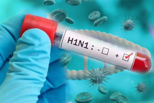 HEALTH NEWS : रहे सावधान... स्वाइन फ्लू के लक्षण भी कोरोना की तरह, वायु कणों व संक्रमित वस्तुओं को छूने से होता है वायरस का प्रसार