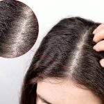 Hair Care: If you are troubled by dandruff in hair, then adopt these tips today itself, there will be no problem of dandruff