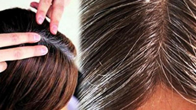 Premature White Hair : कम उम्र में बालों के सफ़ेद होने से हैं परेशान, तो करें इन फूड्स का इस्तेमाल 