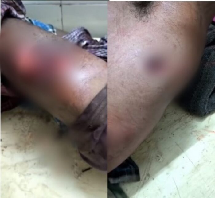 CG NEWS : जंगली सुअर के हमले से एक ग्रामीण घायल, गम्भीर अवस्था में अस्पताल में भर्ती, उपचार जारी...