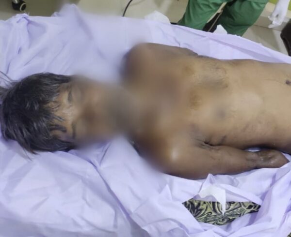 RAIPUR NEWS : अज्ञात कारणों से व्यक्ति ने खाया जहर, इलाज के दौरान मौत 