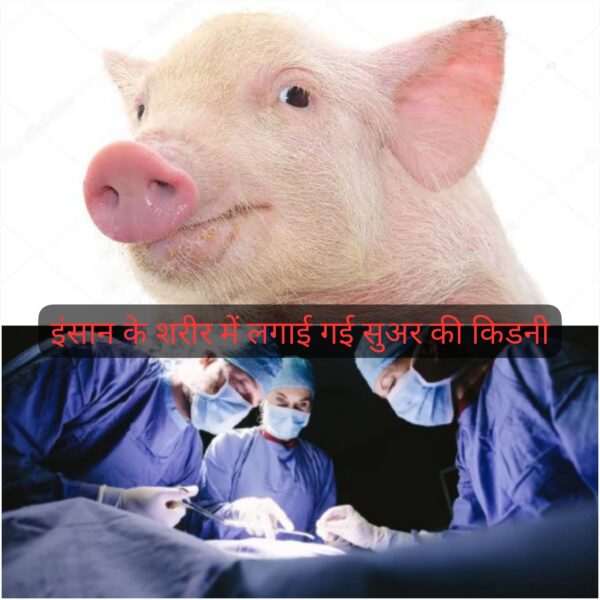 OMG : डॉक्टरों ने बनाया नया रिकॉर्ड, इंसान के शरीर में लगा दी सुअर की किडनी