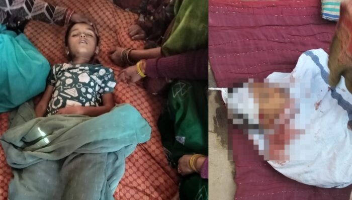 अनूपपुर: MP NEWS : बड़ा हादसा, दीवार गिरने से दो बच्चे की मौके पर ही मौत