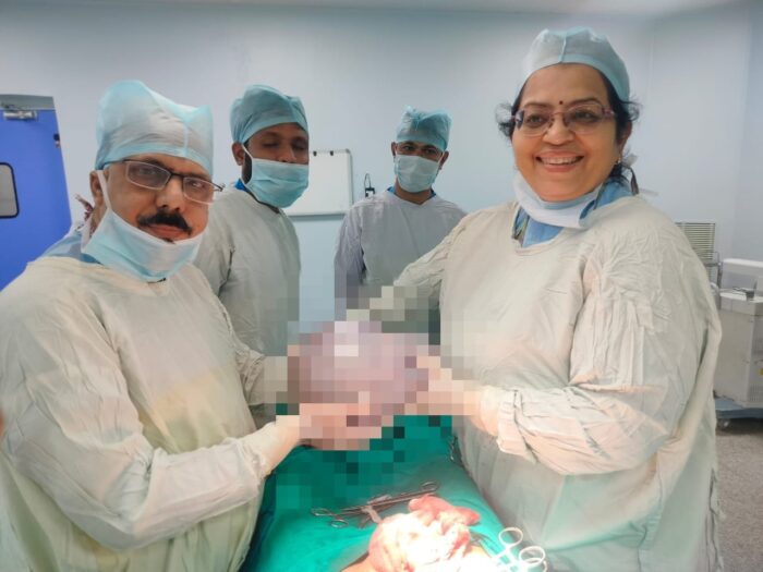  MP NEWS : 70 वर्षीय महिला के पेट से निकला 5 किलो से बड़ा ट्यूमर, डॉक्टरों ने दिया जीवनदान 