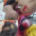 CG CRIME NEWS : दो गुट के किन्नरों के बीच हुई जमकर चाकूबाजी, कई गंभीर रूप से घायल  