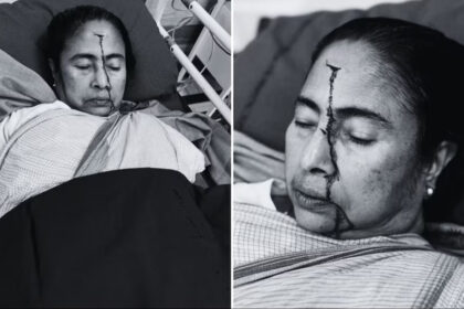  BIG BREAKING : CM Mamata Banerjee के सिर पर लगी गंभीर चोट, अस्पताल में भर्ती