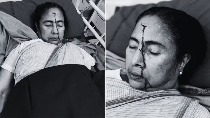  BIG BREAKING : CM Mamata Banerjee के सिर पर लगी गंभीर चोट, अस्पताल में भर्ती