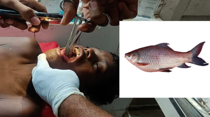 CG AJAB GAJAB NEWS : नहाते समय बच्चे के मुँह में फंसी जिन्दा FISH..., निकालने में डॉक्टरों के छूटे पसीने 
