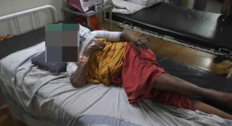 Raigarh News : पेट्रोल डालकर महिला ने वृद्धा को लगाई आग, गंभीर हालत में इलाज जारी