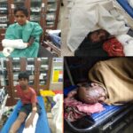 Bhopal News : राजधानी में भयानक हादसा, आकाशीय बिजली गिरने से एक ही परिवार के 4 लोग झुलसे