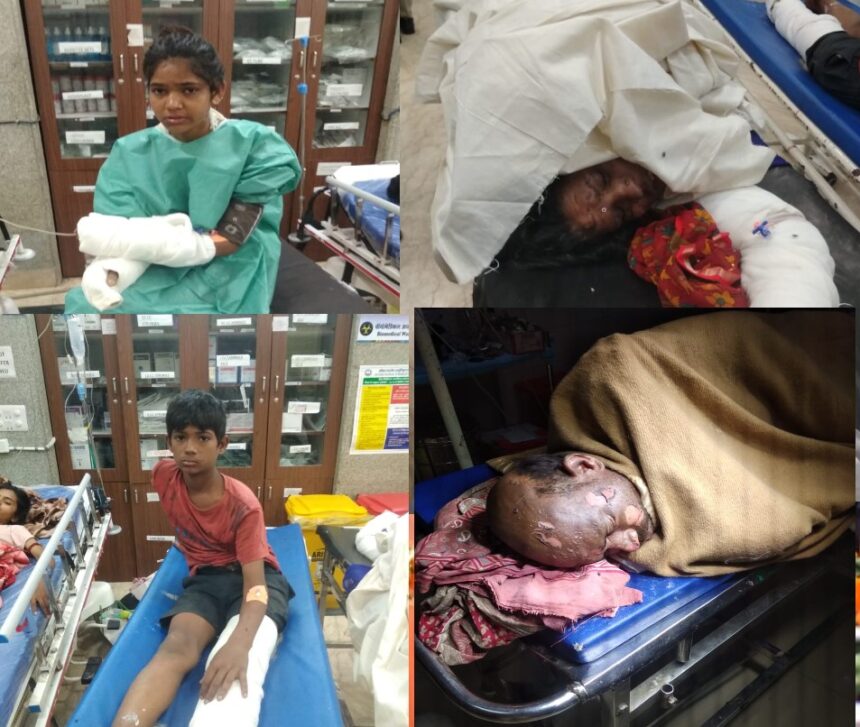 Bhopal News : राजधानी में भयानक हादसा, आकाशीय बिजली गिरने से एक ही परिवार के 4 लोग झुलसे