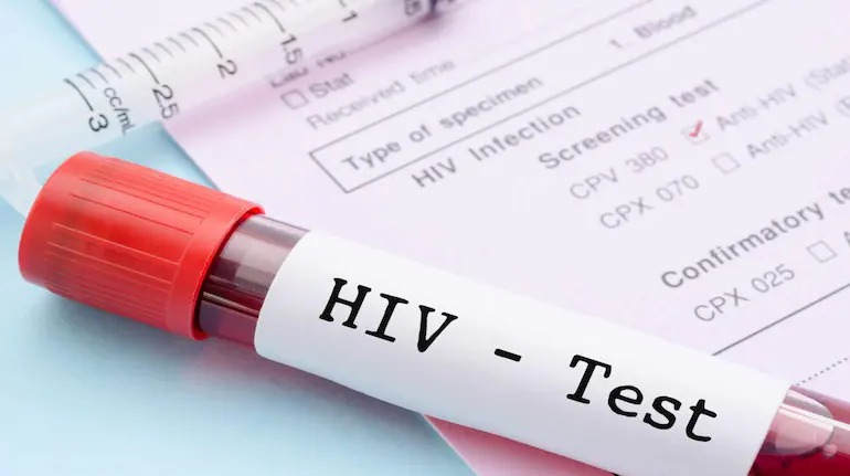 CG NEWS : जिला अस्पताल की बड़ी लापरवाही, टेस्ट के बाद HIV पॉजिटिव मरीज की रिपोर्ट आई नेगेटिव, 5 साल ले रहा था दवाइयां