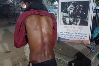 CG: प्लांट में दो नाबालिगों की बेरहमी से पिटाई, बेल्ट से किए गए हमले के मिले निशान