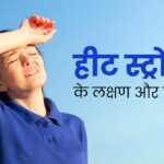 Heat Stroke : हीट स्ट्रोक से कैसे बचे, जानें, इसके कारण और बचाव