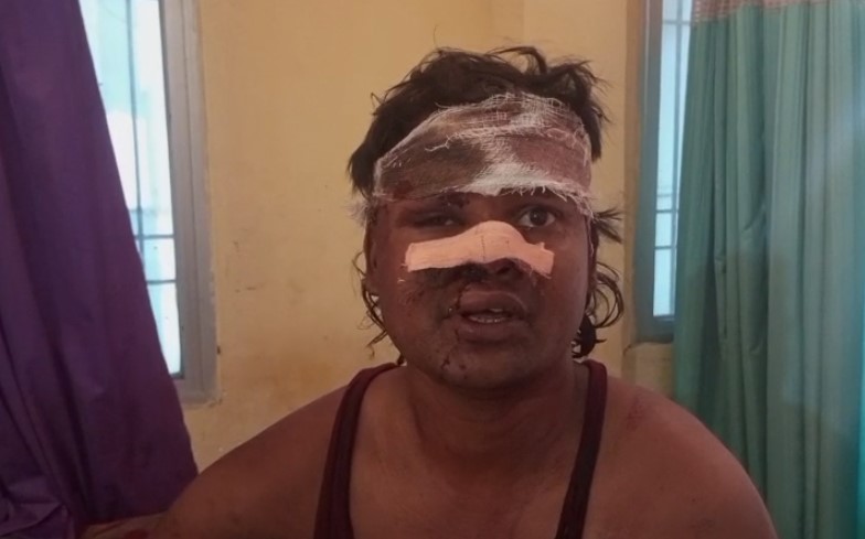 CG BREAKING: नल के पानी को लेकर विवाद, फिजूल बहाने से रोका तो कर दिया खून खराबा, युवक पर चाकू और डंडे से वार, घायल