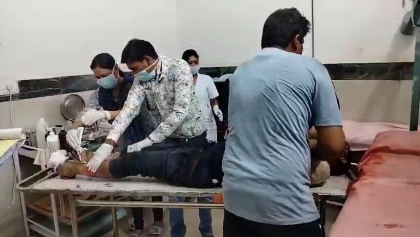 CG BREAKING: लाइन चालू थी या सिस्टम फेल? ट्रांसफार्मर पर चढ़े युवक को लगा करंट, हालत गंभीर
