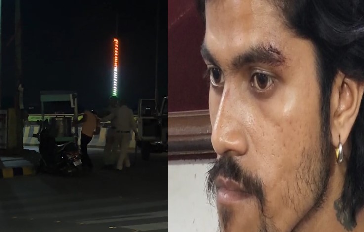 CG Video: सालगिरह पर पति-पत्नी सड़क पर बना रहे थे रील, आरक्षक ने कर दी पिटाई, युवक का कटा आईब्रो