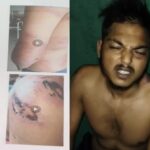 CG: भाजपा पार्षद और गुर्गों की गुंडागर्दी, युवक को बेरहमी से पीटा, पुलिस पर कार्रवाई न करने का आरोप