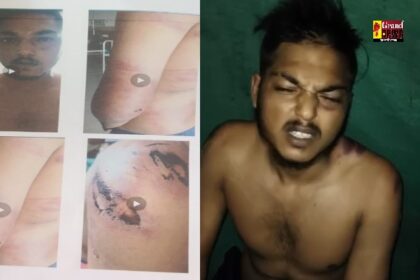 CG: भाजपा पार्षद और गुर्गों की गुंडागर्दी, युवक को बेरहमी से पीटा, पुलिस पर कार्रवाई न करने का आरोप