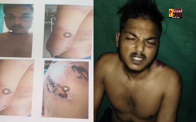 CG: भाजपा पार्षद और गुर्गों की गुंडागर्दी, युवक को बेरहमी से पीटा, पुलिस पर कार्रवाई न करने का आरोप