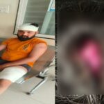 CG NEWS : नशे से रोकने पर संतोषी नगर में चाकूबाजी, चिकन सेंटर संचालक पर जानलेवा हमला