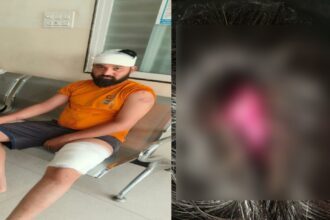 CG NEWS : नशे से रोकने पर संतोषी नगर में चाकूबाजी, चिकन सेंटर संचालक पर जानलेवा हमला