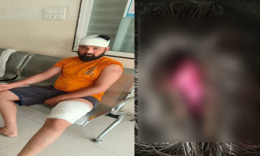 CG NEWS : नशे से रोकने पर संतोषी नगर में चाकूबाजी, चिकन सेंटर संचालक पर जानलेवा हमला