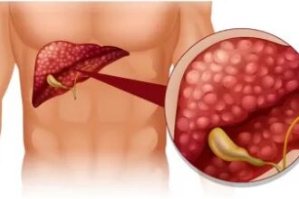 HEALTH TIPS : लिवर में जमा गंदगी का हो जाएगा सफाया, खाली पेट पीना होगा ये ड्रिंक्स