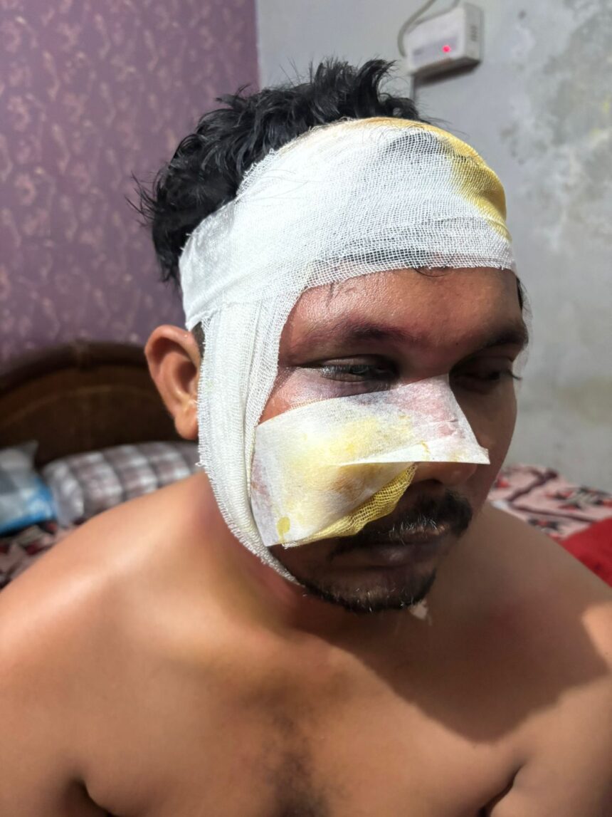 CG : मोबाइल लूट की शिकायत करने पहुंचे युवक के साथ अभद्रता और मारपीट, सिपाही पर गंभीर आरोप