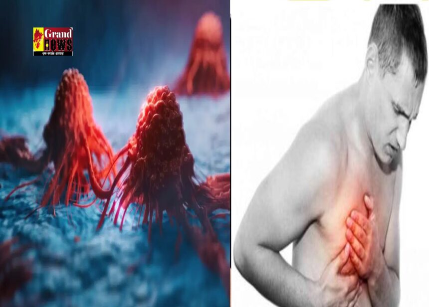 Breast Cancer: पुरुषों को भी हो सकता है ब्रेस्ट कैंसर ! जानिए लक्षण