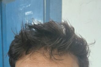 CG