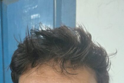 CG