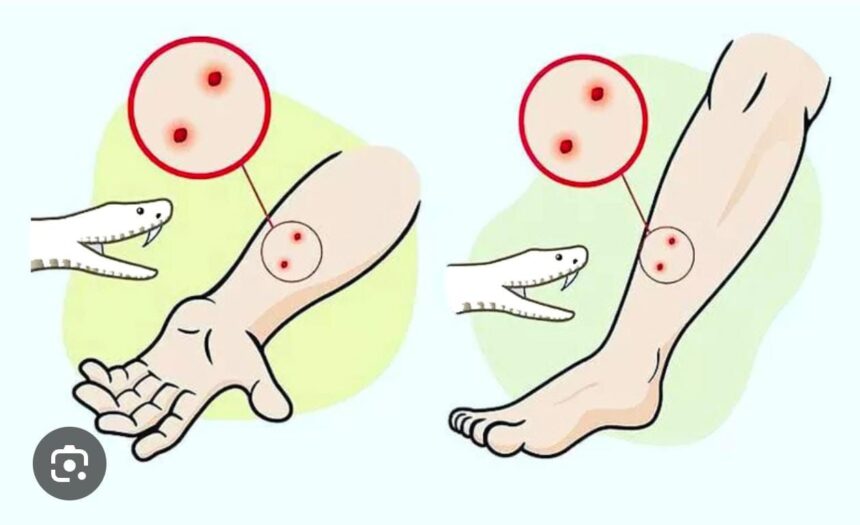 Snakebite : सांप डसे तो झाड़-फूंक में समय न गवाएं, तुरंत अस्पताल पहुंचे, स्वास्थ्य विभाग ने जारी की एडवाइजरी